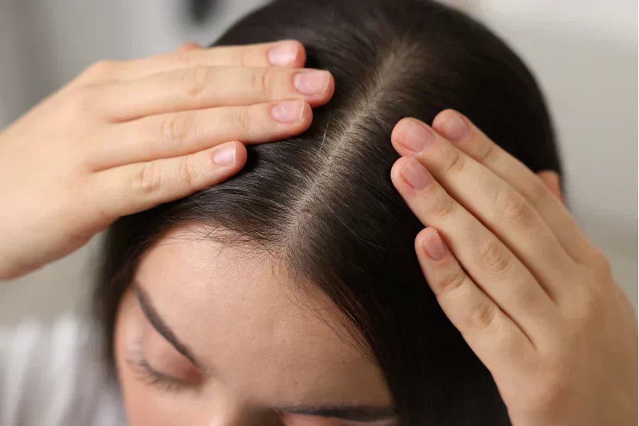 Close up on a woman scalp who is concern about scalp health