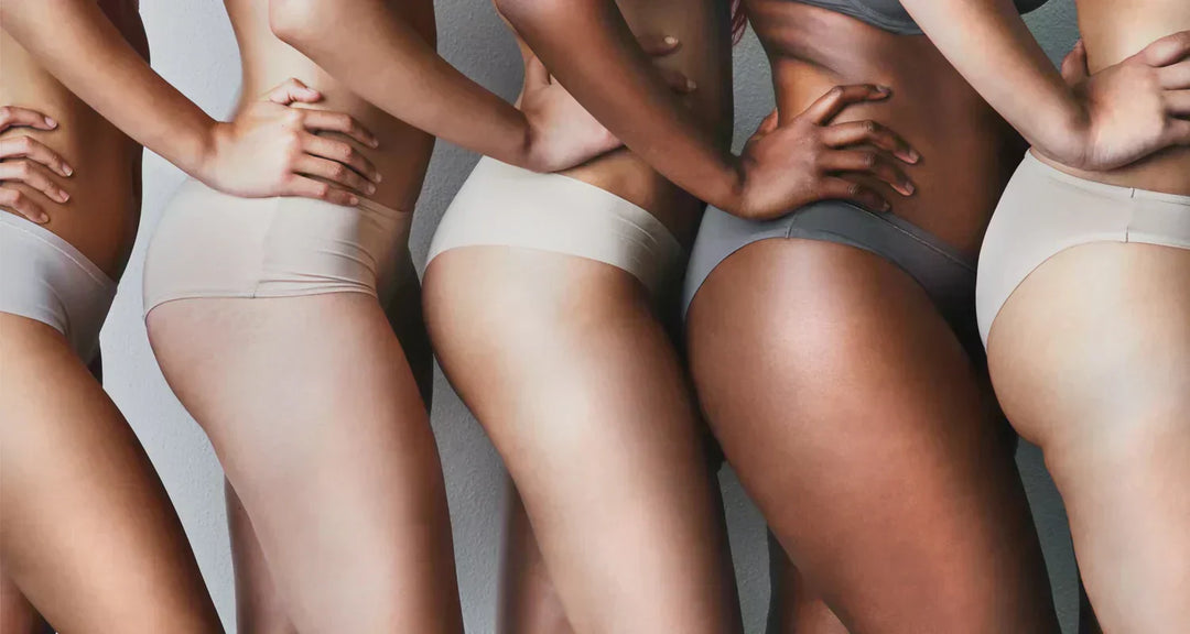 How Microneedling Helps Fade Stretch Marks Naturally