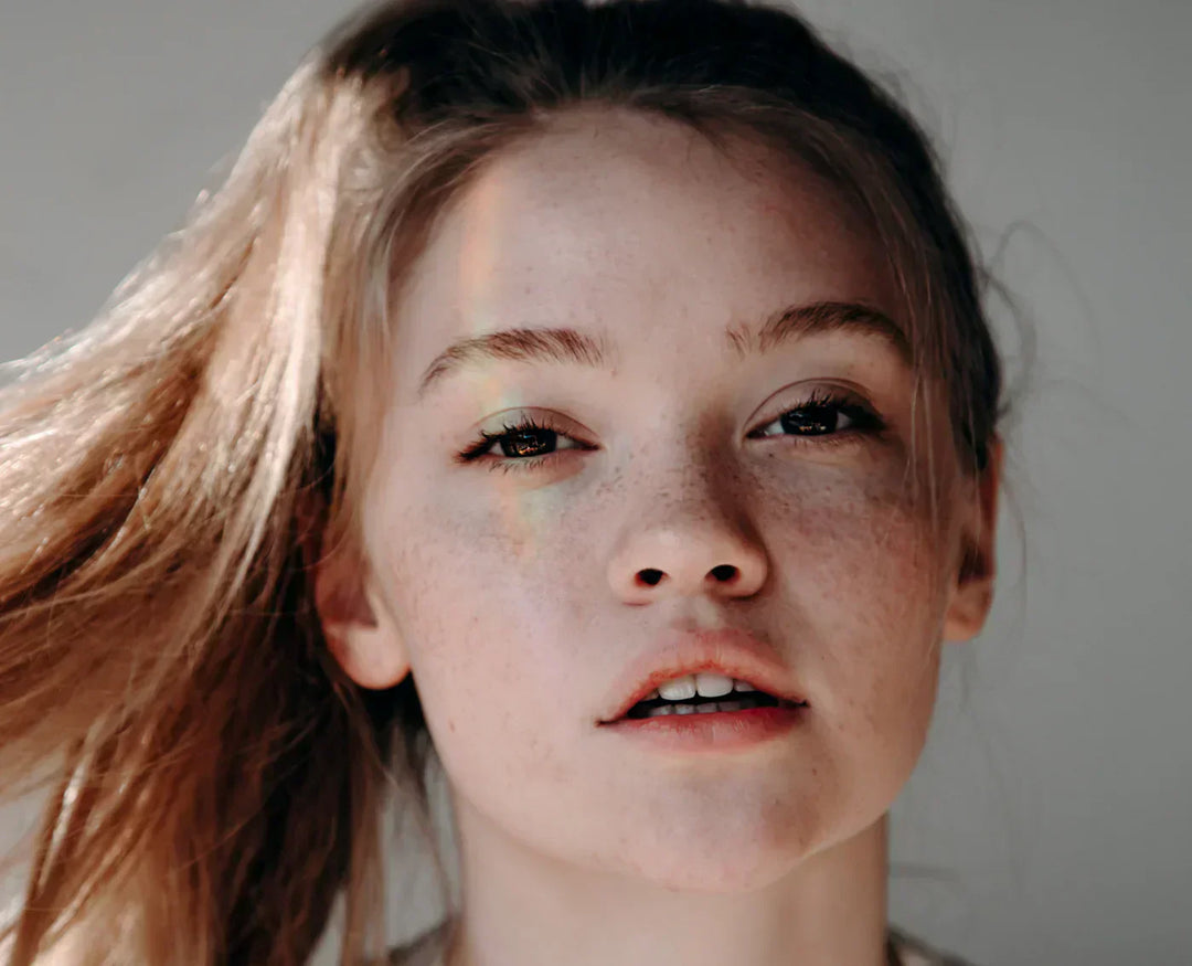 Hyperpigmentation FAQs: What is Hyperpigmentation?