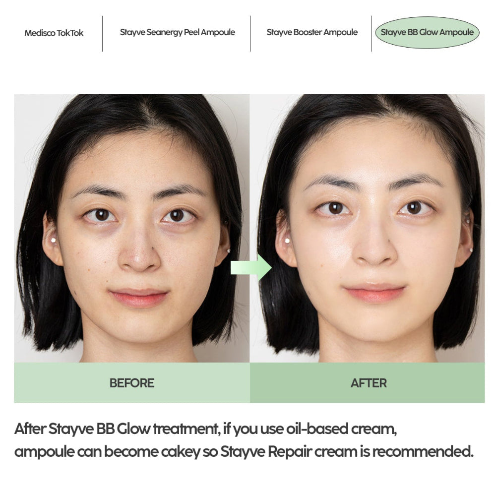 Stayve BB Glow aftercare guide recommending Stayve repair cream after treatment 