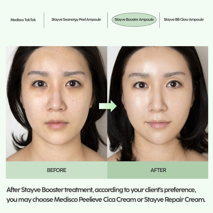 Stayve Booster ampoule aftercare guide that recommends Medisco Peelieve Cica Cream  after treatment as an option